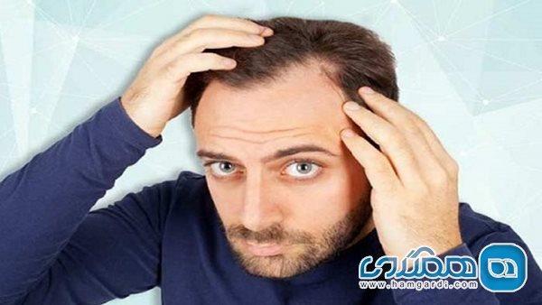 چند توصیه طلایی برای مراقبت از موها در فصل سرما چند توصیه طلایی برای مراقبت از موها در فصل سرما